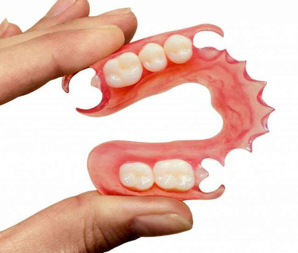 Você conhece a prótese dentária flexível?
